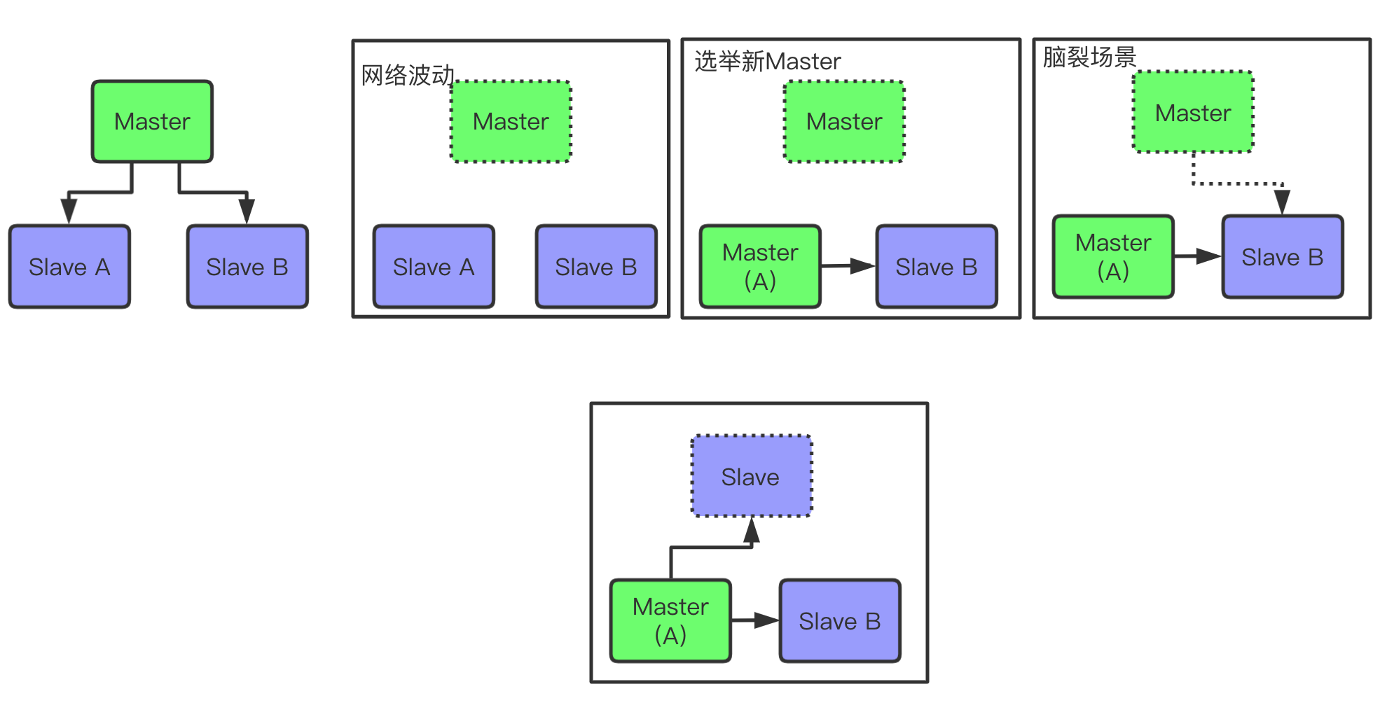 脑裂